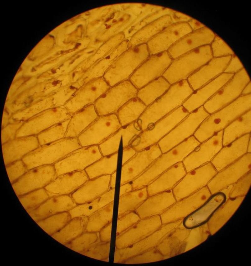 Mengalami perubahan bentuk sesuai dengan fungsinya. Biologi Gonzaga Epidermis Daun Experimen Sederhana