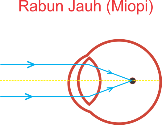 Alat optik yang digunakan untuk melihat . Cakrawala Ilmu 1 2 Cahaya Dan Alat Optik Cacat Mata Miopi Hipermetropi Presbiopi