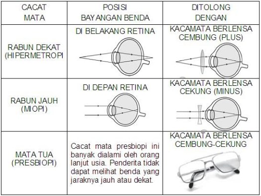 Obat tetes mata dapat digunakan secara rutin pada penderita rabun jauh sesuai dengan resep dokter. Kacamata Berlensa Cekung Digunakan Untuk Membantu Penderita Berbagai Peruntukan