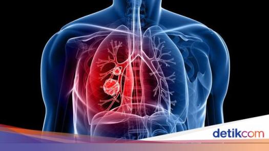 View Fungsi Proses Pernapasan Bagi Tubuh Adalah Sebagai Berikut. Kecuali
&nbsp;PNG