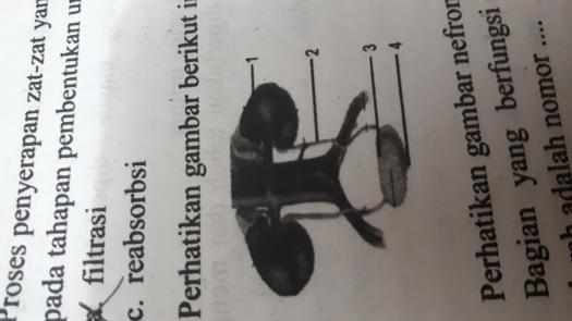 28+ Organ Pada Hewan Dan Manusia Yang Berfungsi Untuk Menyaring Darah Adalah
&nbsp;PNG