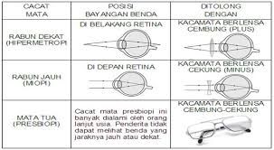 50+ Kaca Mata Berlensa Cekung Digunakan Untuk Menolong Penderita Cacat Mata
&nbsp;Gif