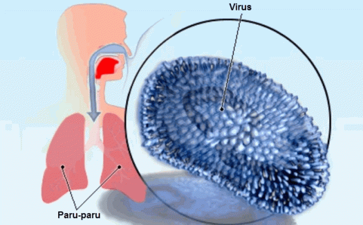Download Apa Yang Kamu Lakukan Untuk Mencegah Terkena Penyakit Gangguan Pernapasan
Images