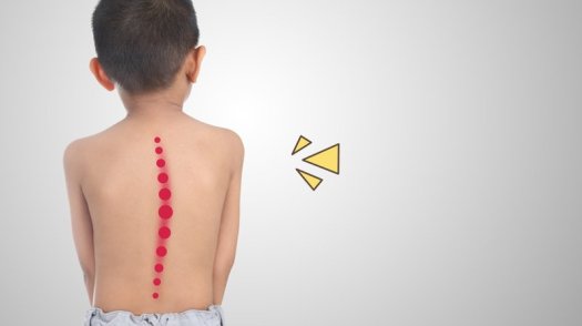 Download Perhatikan Gambar Disamping Kelainan Tulang Yang Terdapat Pada Gambar Adalah
&nbsp;Gif